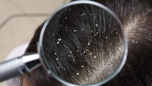 Happy-Scalp-Happy-Curls-Your-Guide-to-Natural-Scalp-Detox Wuli Grooming